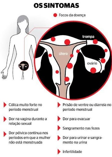 Sangramento vaginal fora do período menstrual: o que pode ser e causas